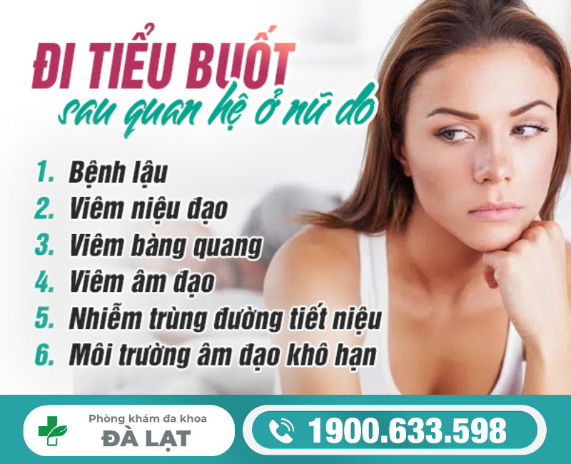 Hình ảnh minh họa